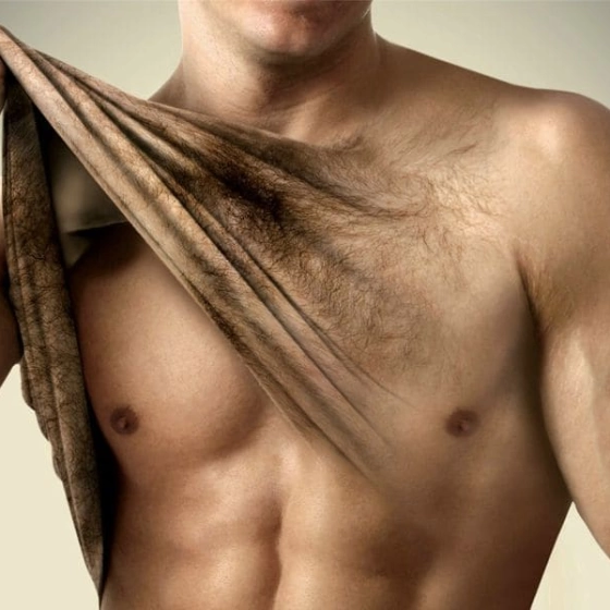 Лазерная эпиляция для мужчин